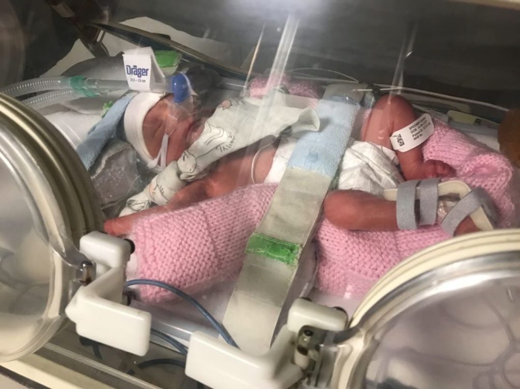 Birth Trauma and Preeclampsia:
Baby in incubator