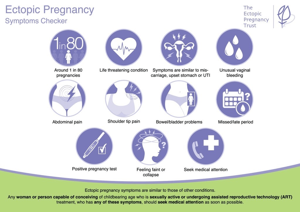 ectopic pregnancy symptoms